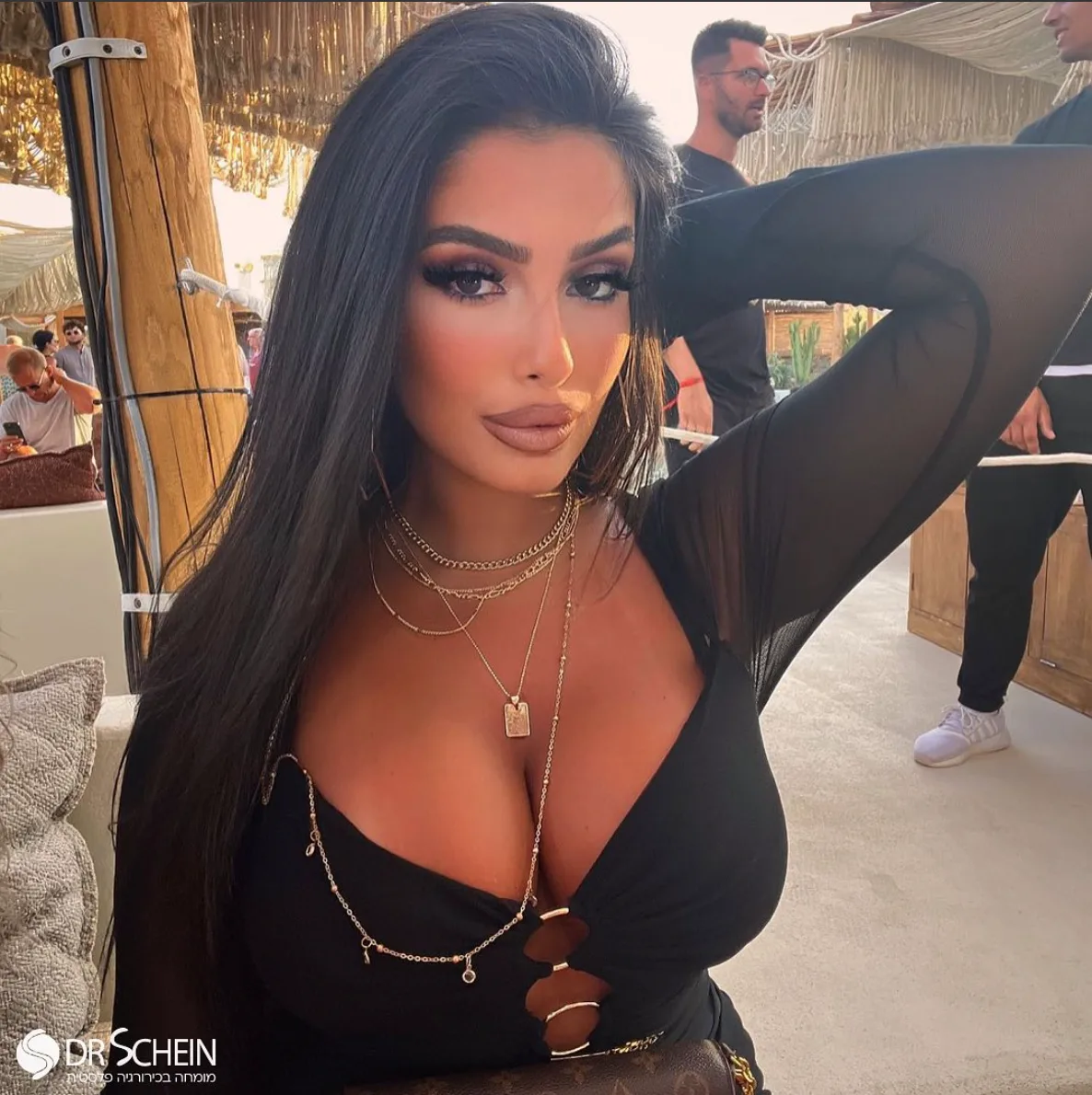 הגדלת חזה – דר׳ אופיר שיין